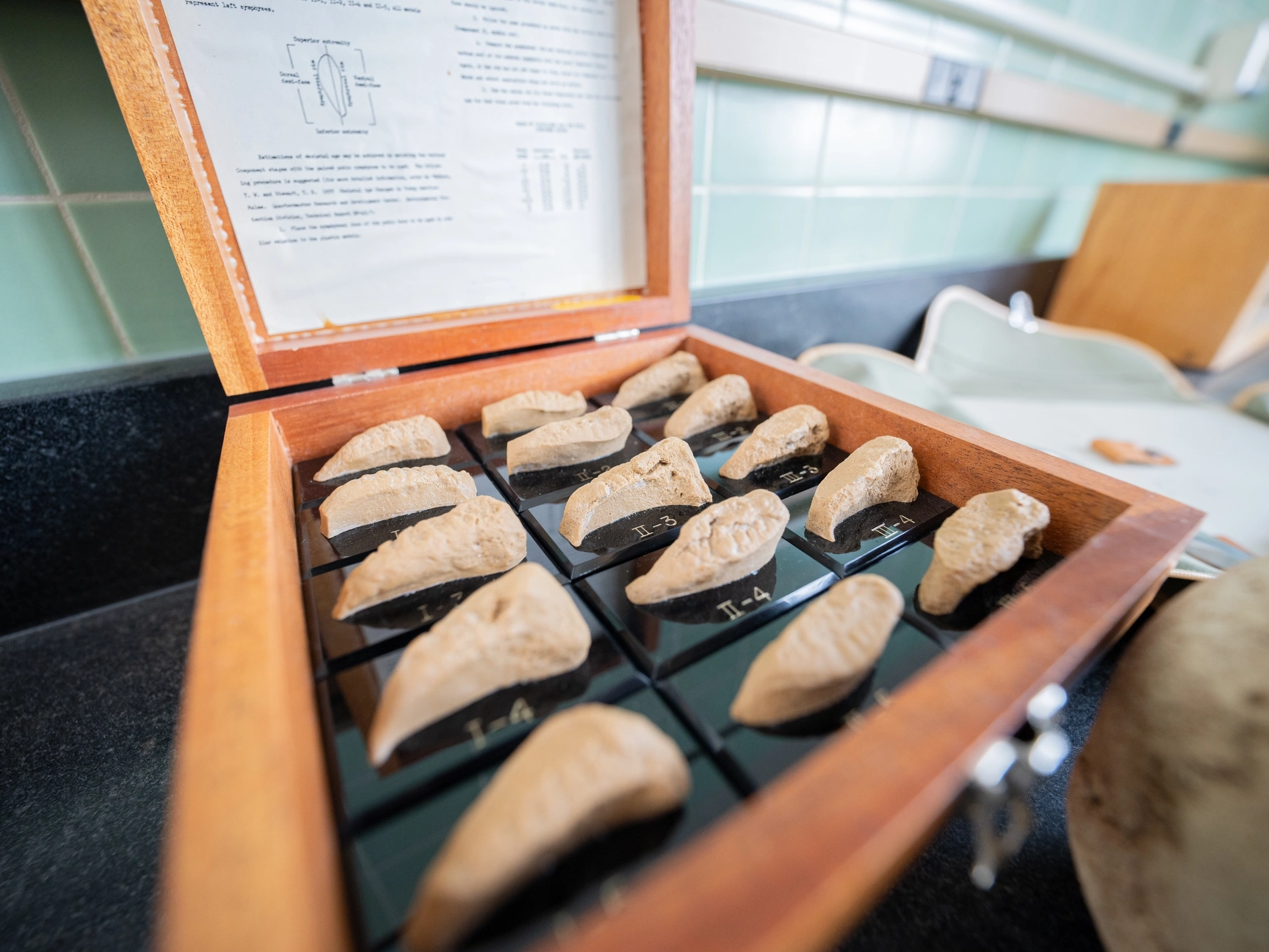 Human bones being displayed inside a wooden case