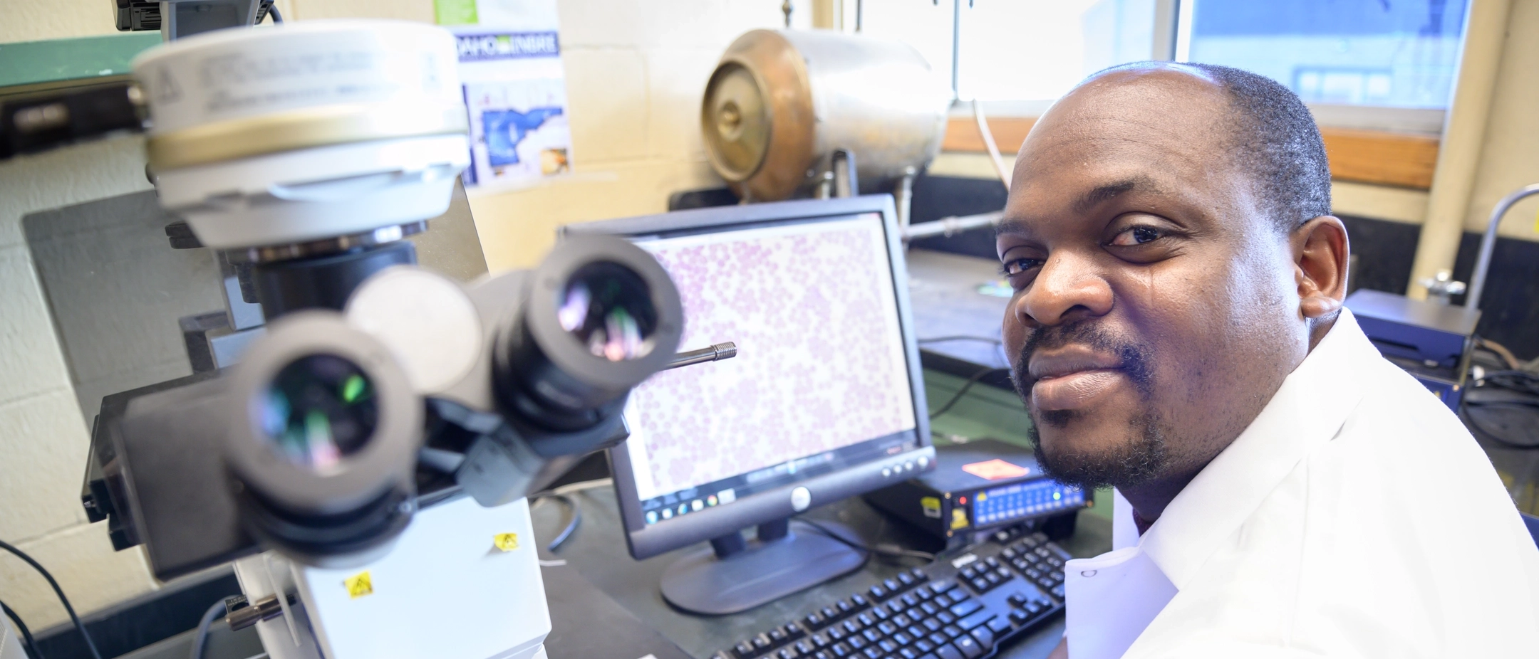 Ezekiel Adekanmbi, innovation month feature for research to identify bebesiosis, a microorganism so often misidentified as malaria, and Lyme disease in early stages