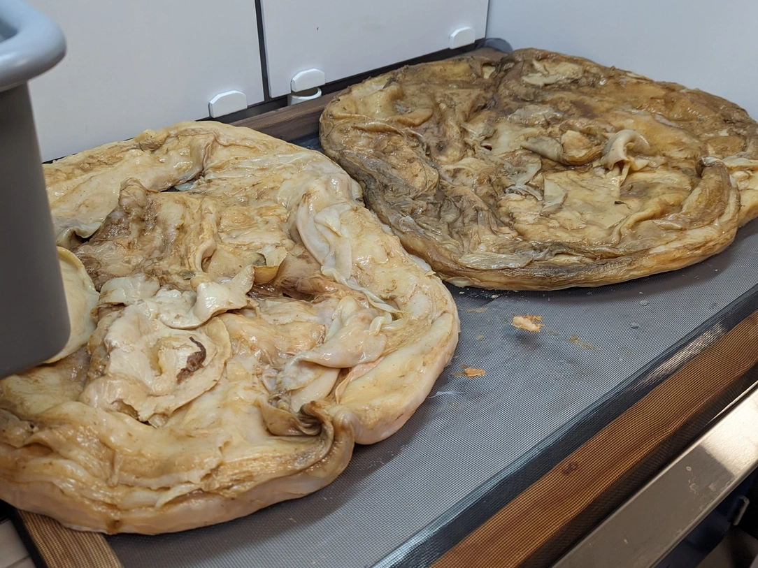Two large SCOBY’s lay on a table